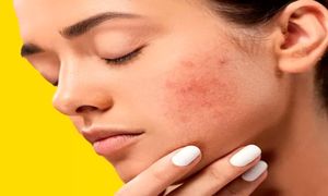 داشتن پوستی یکدست و صاف با کرم پودر رویال اترنیتی
