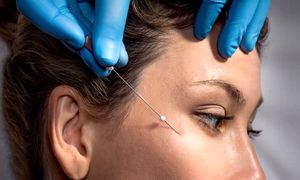 بهترین کلینیک لیفت صورت با نخ در اصفهان کدام است؟